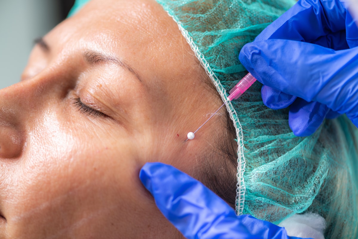 Tratamiento peeling químico